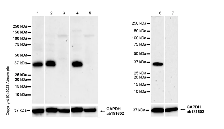 Western blot - Anti-SYNPR antibody [EPR28139-74] (AB314136)