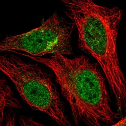 Immunocytochemistry/ Immunofluorescence - Anti-Syntaxin 12/Syntaxin-13 antibody (AB220746)