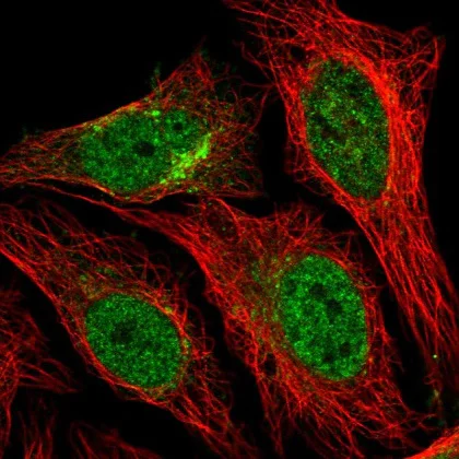 Immunocytochemistry/ Immunofluorescence - Anti-Syntaxin 12/Syntaxin-13 antibody (AB220746)