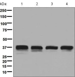 Western blot - Anti-Syntaxin 16 antibody [EPR9156] (AB134945)