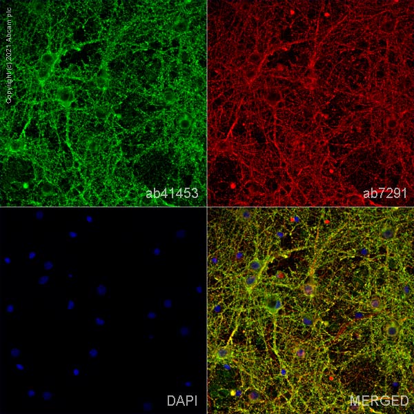 Immunocytochemistry/ Immunofluorescence - Anti-Syntaxin 1a antibody (AB41453), expandable thumbnail