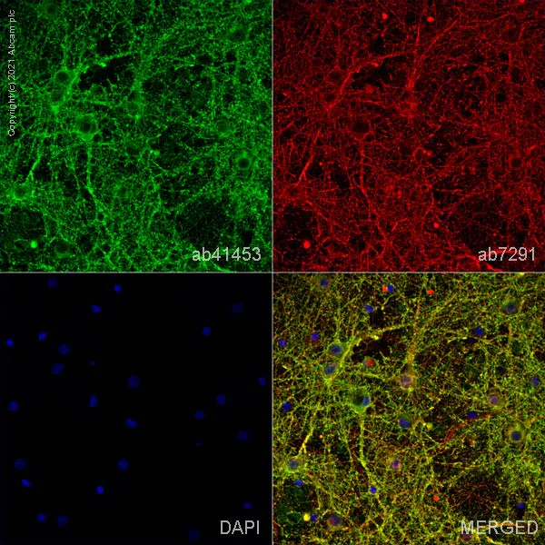 Immunocytochemistry/ Immunofluorescence - Anti-Syntaxin 1a antibody (AB41453)