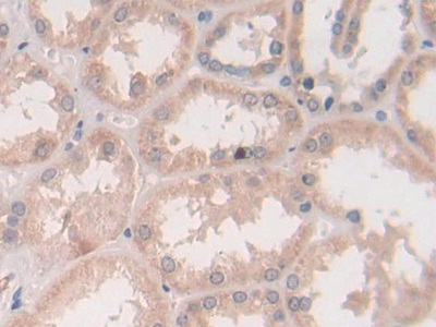 Immunohistochemistry (Formalin/PFA-fixed paraffin-embedded sections) - Anti-Syntaxin 2/STX2 antibody (AB233275), expandable thumbnail