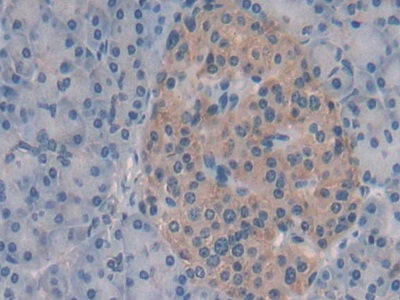 Immunohistochemistry (Formalin/PFA-fixed paraffin-embedded sections) - Anti-Syntaxin 2/STX2 antibody (ab233275), expandable thumbnail