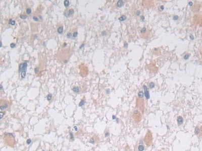 Immunohistochemistry (Formalin/PFA-fixed paraffin-embedded sections) - Anti-Syntaxin 2/STX2 antibody (AB233275), expandable thumbnail