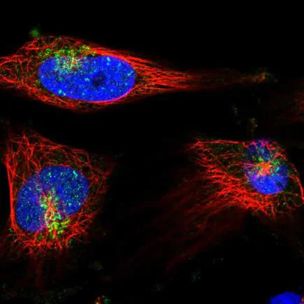 Immunocytochemistry/ Immunofluorescence - Anti-Syntaxin 6 antibody - Golgi Membrane Marker (AB243719)