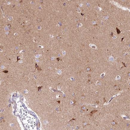 Immunohistochemistry (Formalin/PFA-fixed paraffin-embedded sections) - Anti-Syntaxin 6 antibody - Golgi Membrane Marker (AB243719)