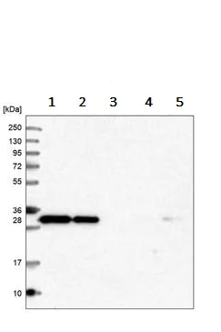 Western blot - Anti-Syntaxin 6 antibody - Golgi Membrane Marker (AB243719)