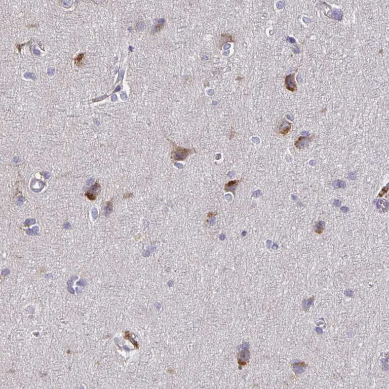 Immunohistochemistry (Formalin/PFA-fixed paraffin-embedded sections) - Anti-Syntaxin 7 antibody (AB224223)
