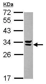 Western blot - Anti-Syntenin 2 antibody (AB229222)