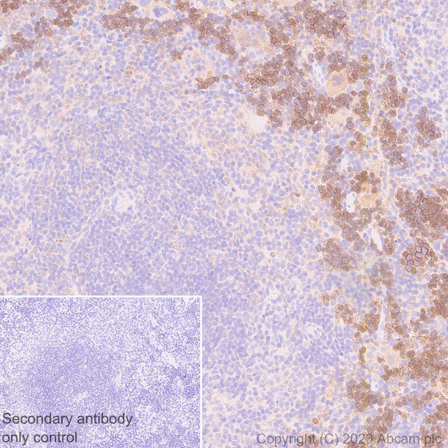Immunohistochemistry (Formalin/PFA-fixed paraffin-embedded sections) - Anti-Syntenin antibody [EPR28604-40] (ab315342), expandable thumbnail