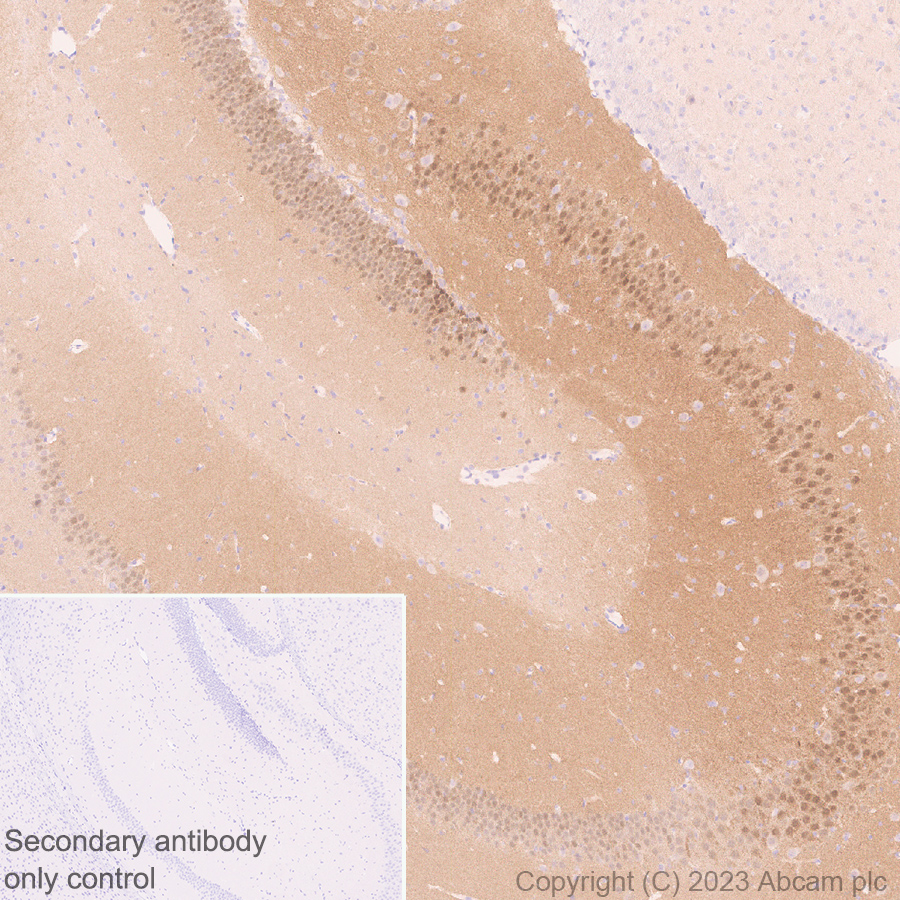 Immunohistochemistry (Formalin/PFA-fixed paraffin-embedded sections) - Anti-Syntenin antibody [EPR28604-40] (ab315342), expandable thumbnail