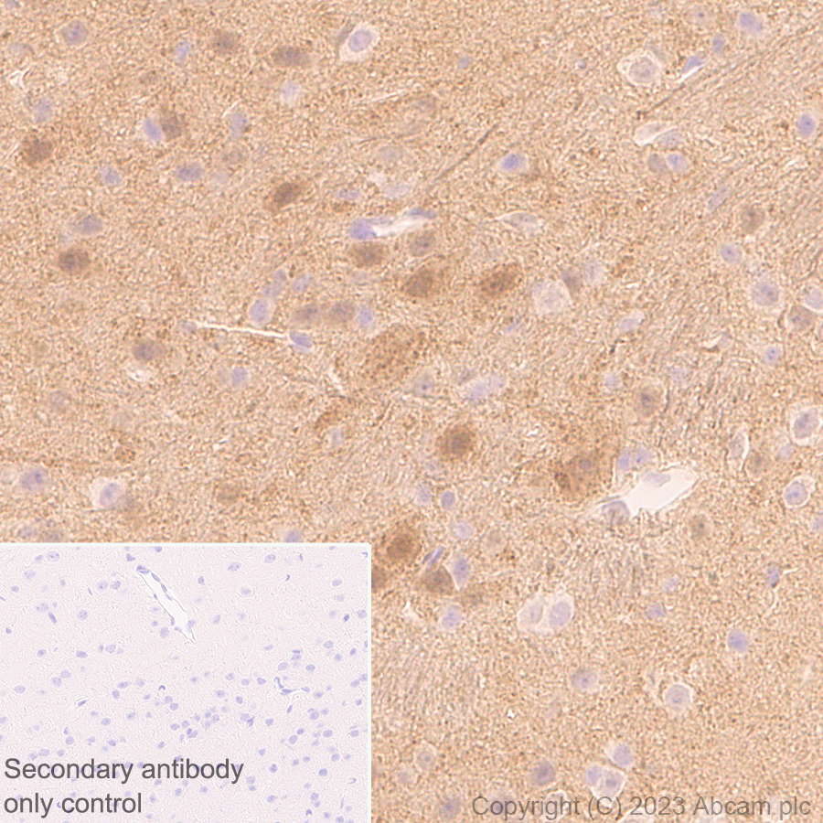Immunohistochemistry (Formalin/PFA-fixed paraffin-embedded sections) - Anti-Syntenin antibody [EPR28604-40] (ab315342), expandable thumbnail