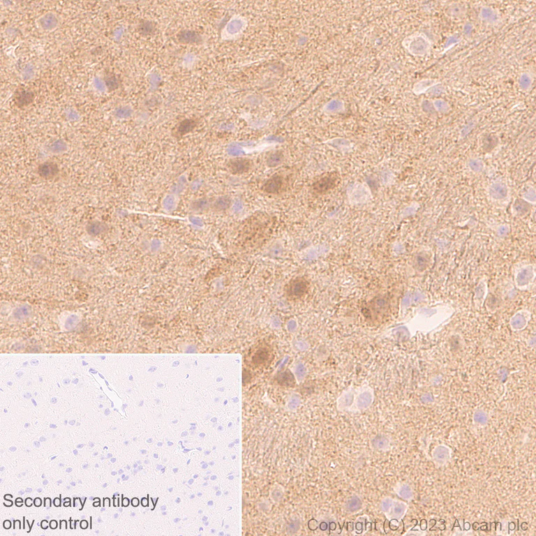 Immunohistochemistry (Formalin/PFA-fixed paraffin-embedded sections) - Anti-Syntenin antibody [EPR28604-40] (AB315342)