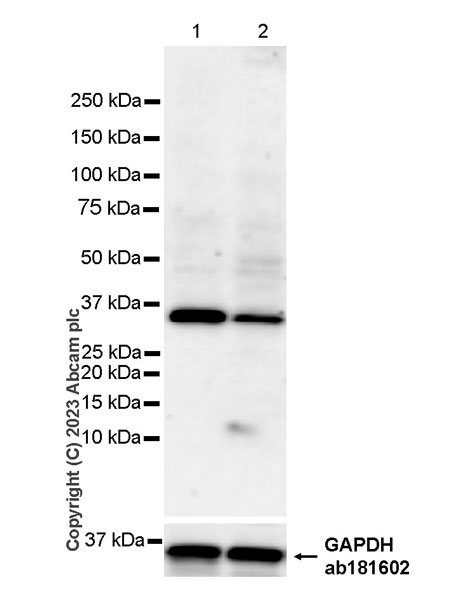 Western blot - Anti-Syntenin antibody [EPR28604-40] (AB315342), expandable thumbnail