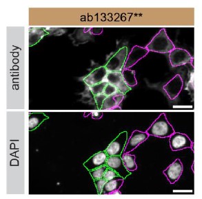 Anti-Syntenin antibody [EPR8102] (ab133267) | Abcam
