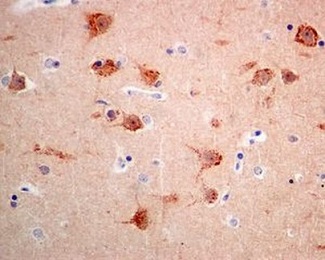 Immunohistochemistry (Formalin/PFA-fixed paraffin-embedded sections) - Anti-Syntenin antibody [EPR8102] (ab133267), expandable thumbnail