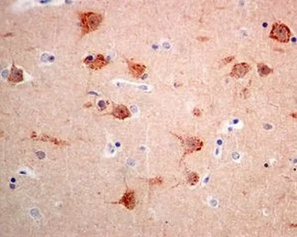 Immunohistochemistry (Formalin/PFA-fixed paraffin-embedded sections) - Anti-Syntenin antibody [EPR8102] - BSA and Azide free (AB236071)