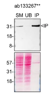 Immunoprecipitation - Anti-Syntenin antibody [EPR8102] - BSA and Azide free (AB236071)