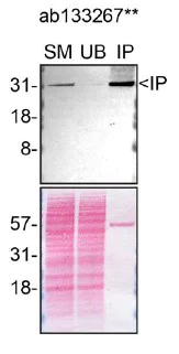 Immunoprecipitation - Anti-Syntenin antibody [EPR8102] - BSA and Azide free (AB236071)