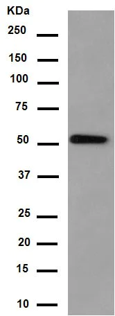 Western blot - Anti-Syntrophin alpha 1 antibody [EPR14828] (AB188873)