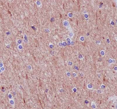 Immunohistochemistry (Formalin/PFA-fixed paraffin-embedded sections) - Anti-Syntrophin alpha 1 antibody [EPR14828] - BSA and Azide free (AB239008), expandable thumbnail