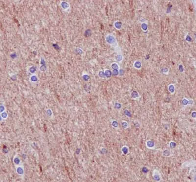 Immunohistochemistry (Formalin/PFA-fixed paraffin-embedded sections) - Anti-Syntrophin alpha 1 antibody [EPR14828] - BSA and Azide free (AB239008)