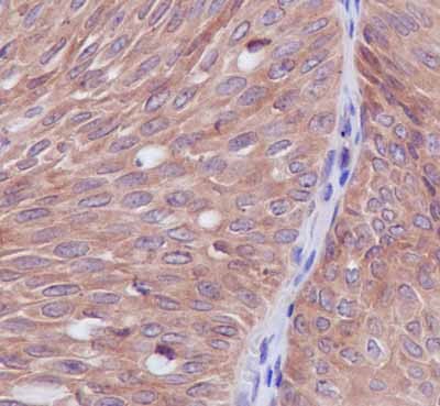 Immunohistochemistry (Formalin/PFA-fixed paraffin-embedded sections) - Anti-Syntrophin alpha 1 antibody [EPR14828] - BSA and Azide free (AB239008), expandable thumbnail