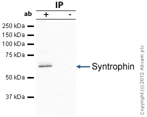 Immunoprecipitation - Anti-Syntrophin antibody [1351] (AB11425)