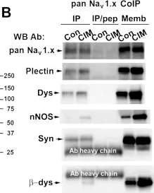 Western blot - Anti-Syntrophin antibody [1351] (AB11425)