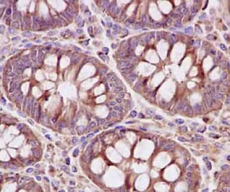 Immunohistochemistry (Formalin/PFA-fixed paraffin-embedded sections) - Anti-SYPL1 antibody [EPR14317] (AB184176)