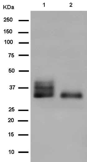 Western blot - Anti-SYPL1 antibody [EPR14317] (AB184176)