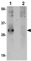 Western blot - Anti-SYPL2 antibody (AB106438)