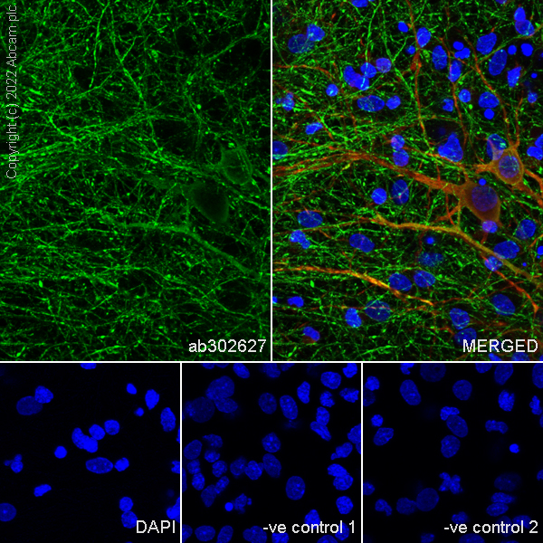 Immunocytochemistry/ Immunofluorescence - Anti-SYT1 antibody [EPR24488-129] (ab302627), expandable thumbnail