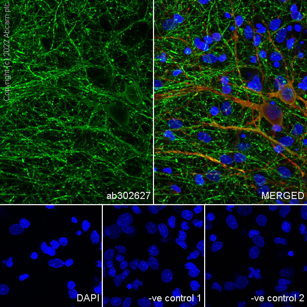 Immunocytochemistry/ Immunofluorescence - Anti-SYT1 antibody [EPR24488-129] (AB302627)