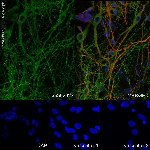 Immunocytochemistry/ Immunofluorescence - Anti-SYT1 antibody [EPR24488-129] (AB302627), expandable thumbnail