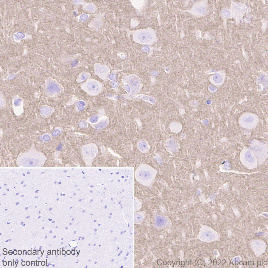 Immunohistochemistry (Formalin/PFA-fixed paraffin-embedded sections) - Anti-SYT1 antibody [EPR24488-129] (ab302627), expandable thumbnail