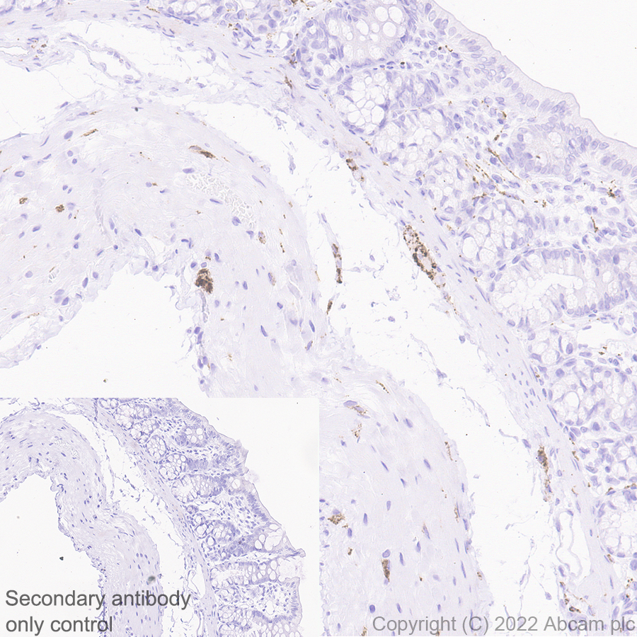 Immunohistochemistry (Formalin/PFA-fixed paraffin-embedded sections) - Anti-SYT1 antibody [EPR24488-129] (ab302627), expandable thumbnail