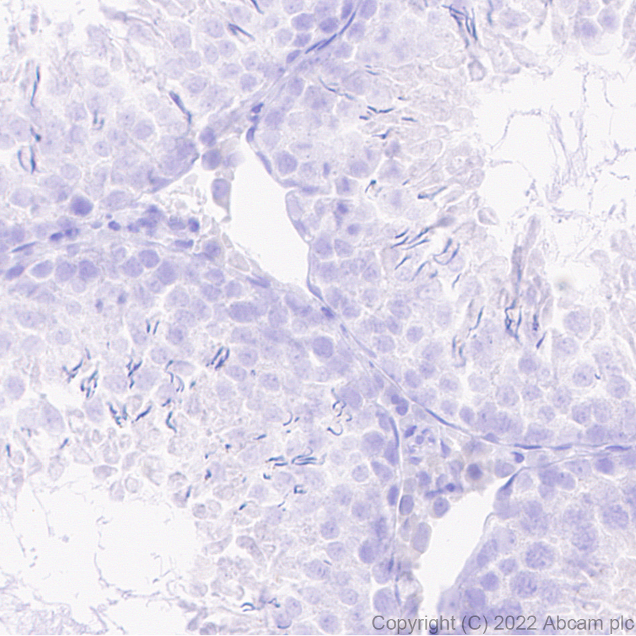 Immunohistochemistry (Formalin/PFA-fixed paraffin-embedded sections) - Anti-SYT1 antibody [EPR24488-129] (ab302627), expandable thumbnail