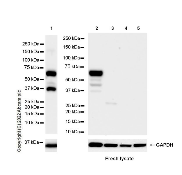 Western blot - Anti-SYT1 antibody [EPR24488-129] (ab302627), expandable thumbnail
