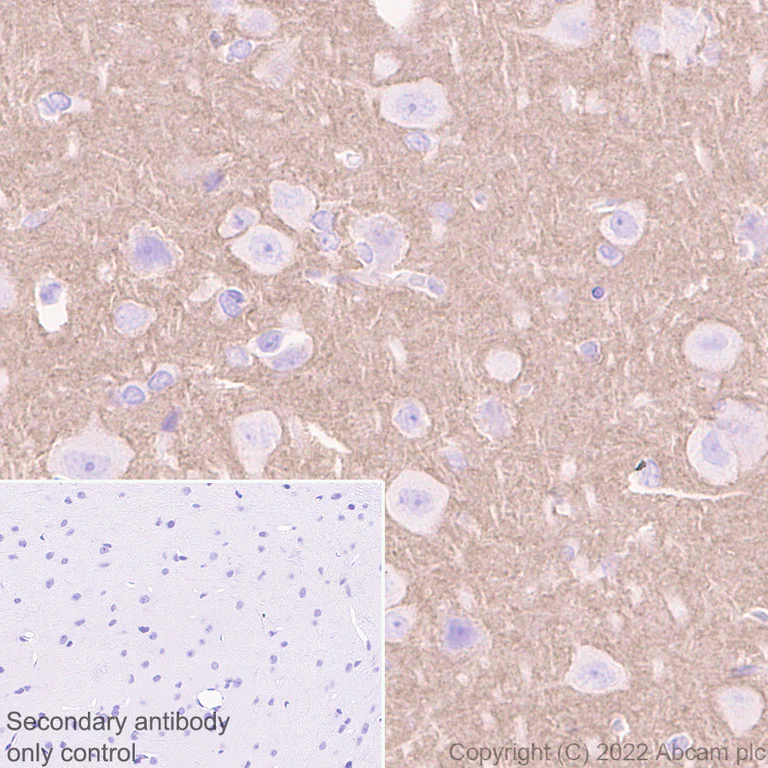 Immunohistochemistry (Formalin/PFA-fixed paraffin-embedded sections) - Anti-SYT1 antibody [EPR24488-129] (BSA and Azide free) (AB302628)