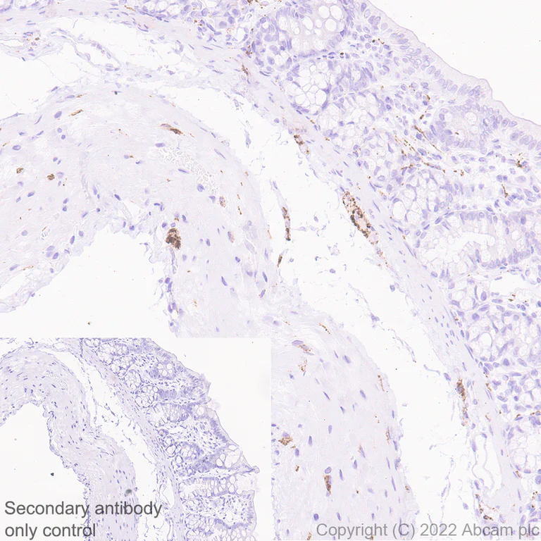 Immunohistochemistry (Formalin/PFA-fixed paraffin-embedded sections) - Anti-SYT1 antibody [EPR24488-129] (BSA and Azide free) (AB302628)
