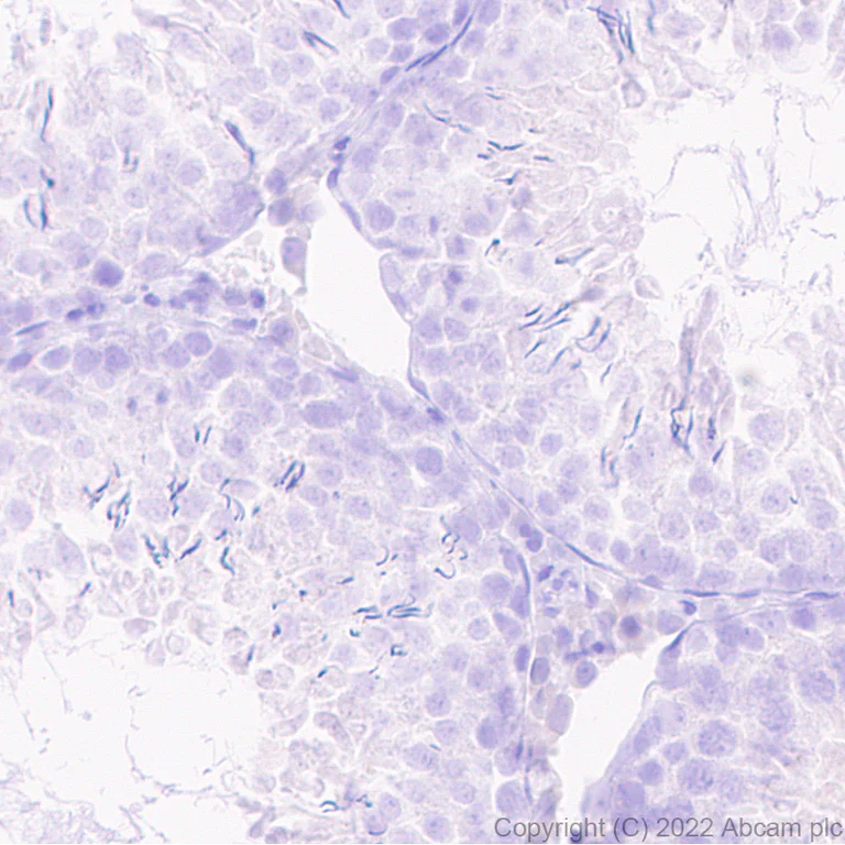 Immunohistochemistry (Formalin/PFA-fixed paraffin-embedded sections) - Anti-SYT1 antibody [EPR24488-129] (BSA and Azide free) (AB302628)