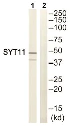 Western blot - Anti-SYT11 antibody (AB110766)
