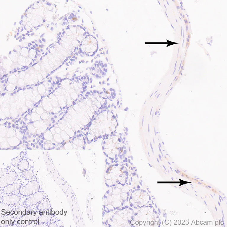 Immunohistochemistry (Formalin/PFA-fixed paraffin-embedded sections) - Anti-SYT13 antibody [EPR26923-67] (AB313329)