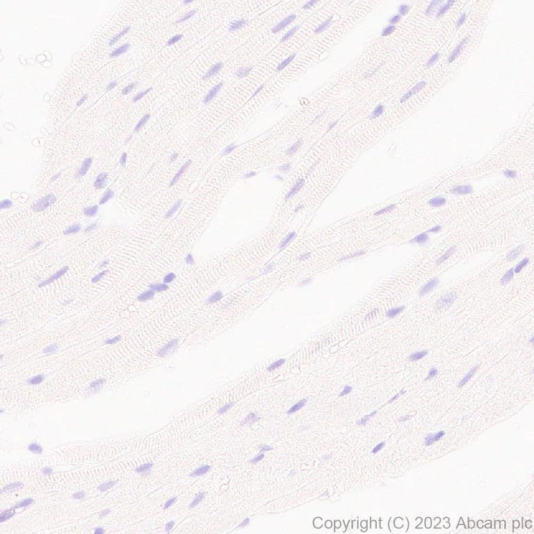 Immunohistochemistry (Formalin/PFA-fixed paraffin-embedded sections) - Anti-SYT13 antibody [EPR26923-67] (AB313329)