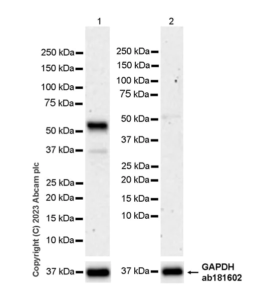Western blot - Anti-SYT13 antibody [EPR26923-67] (AB313329)