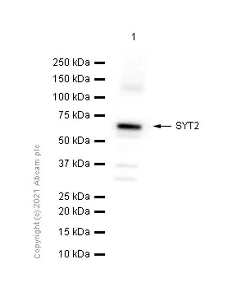Western blot - Anti-SYT2 antibody [EPR13204] (AB181123)