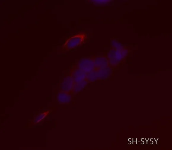 Immunocytochemistry/ Immunofluorescence - Anti-SYT2 antibody [ZNP-1] (AB154035)