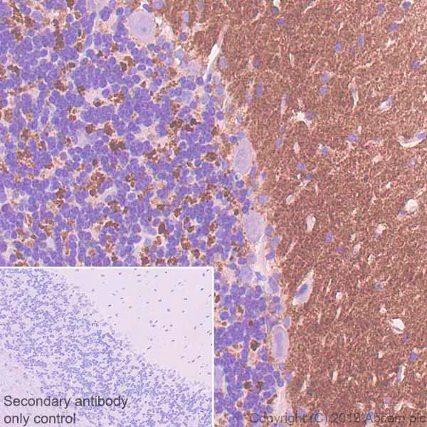 Immunohistochemistry (Formalin/PFA-fixed paraffin-embedded sections) - Anti-SYT2 antibody [ZNP-1] (AB154035)